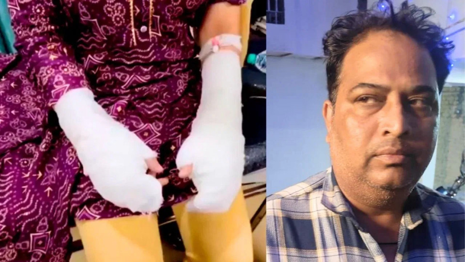 Delhi Acid Attack