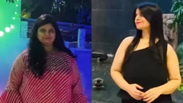 'I Quit Sugar for 6 Months and Lost 30 Kg’: Dentist Shares Stunning Before and After Pics of Her Transformation