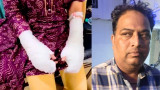 Delhi Acid Attack