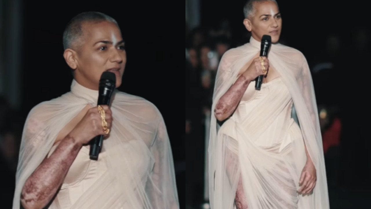 Navkirat Sodhi: The Resilient Poet Who Turned Burn Injuries into a Symbol of Strength at Gaurav Gupt