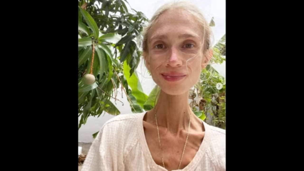 Young Woman, 27, Found Dead in Bali Hotel After Following Extreme Fruitarian Diet